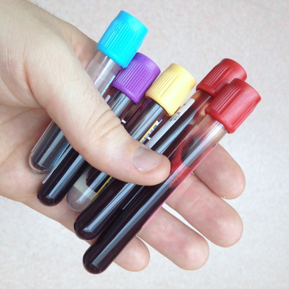 Vitamine B12 tekort alles over de symptomen, test, oorzaak & behandeling Vitamine B12 tekort alles over de symptomen, test, oorzaak & behandeling