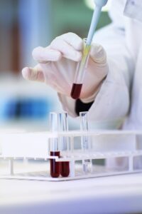 bloedtest in laboratorium